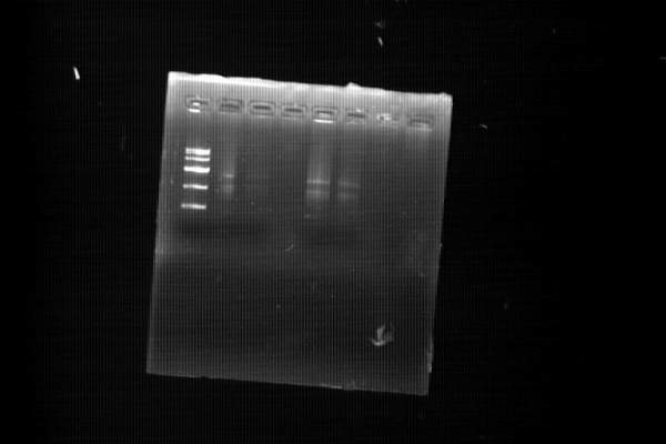 rna 电泳图 求解