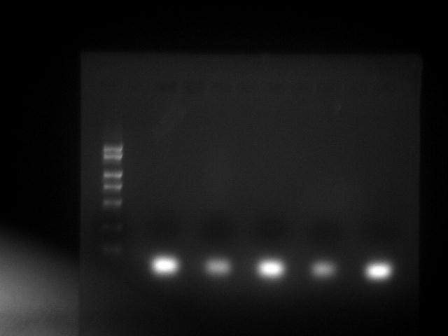 请帮忙分析琼脂糖凝胶电泳图