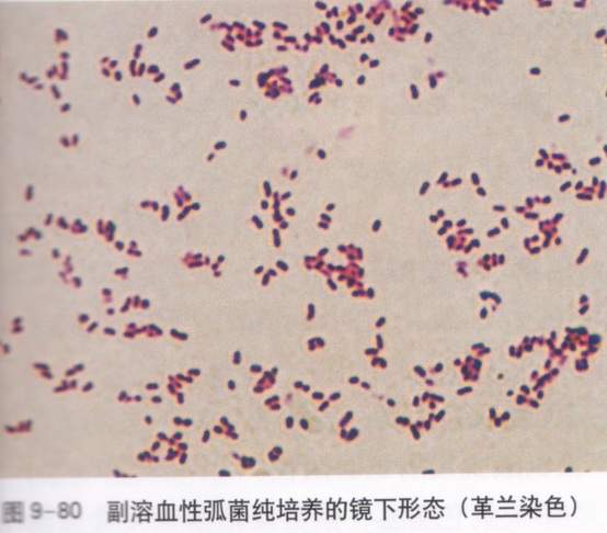 求助副溶血弧菌的照片