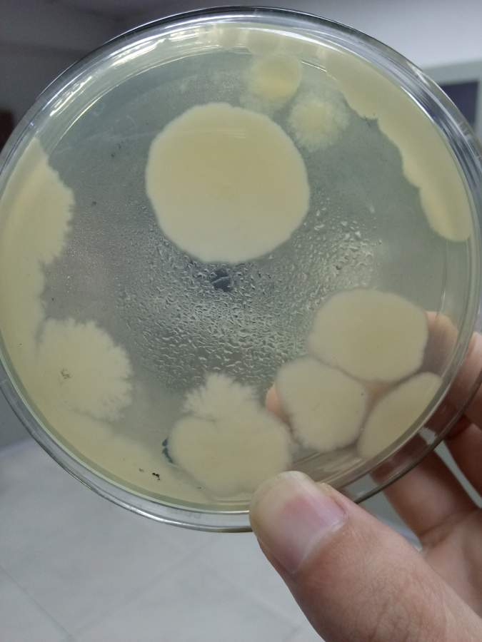 为什么空白平板长满了菌,不知道这是什么菌,请问各位大神有谁可以知道