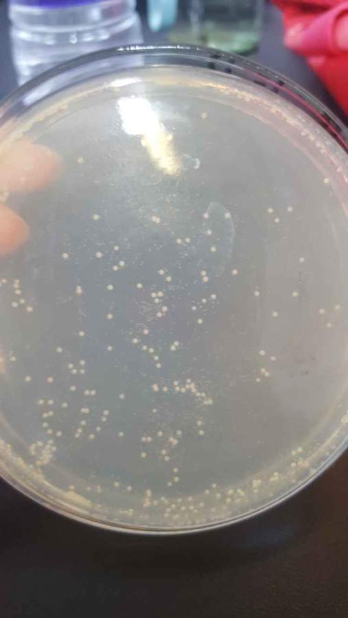 嗜酸乳杆菌与瑞士乳杆菌菌落形态是什么样子的