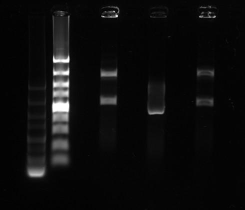 求助琼脂糖凝胶电泳!!marker拖尾得厉害- 分子生物- 综合其他- 小木虫