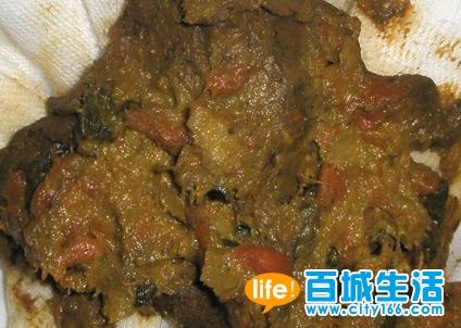 详细图片解释宝宝的大便情况