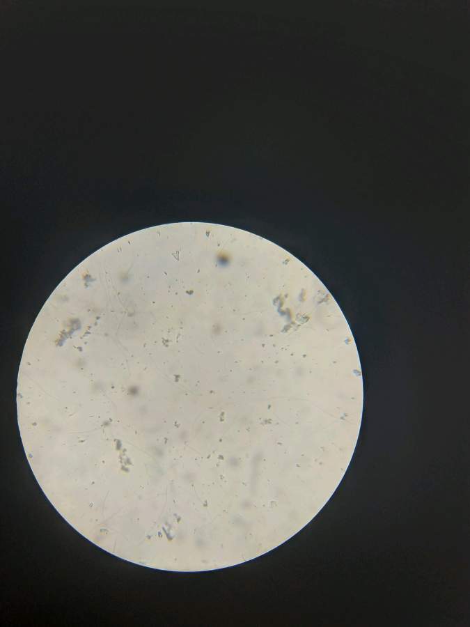 在显微镜下看细菌像头发丝一样,属于哪种细菌类?