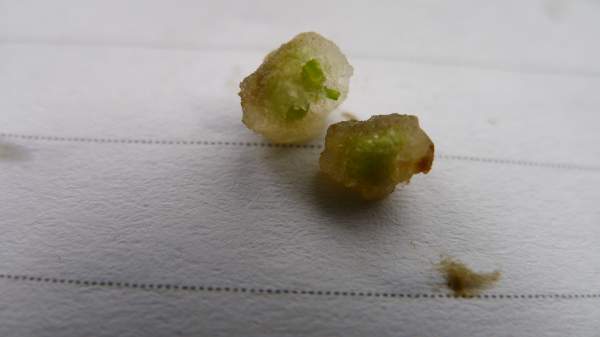 三叶木通愈伤组织