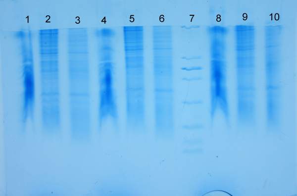 tricine-sds-page电泳结果分析