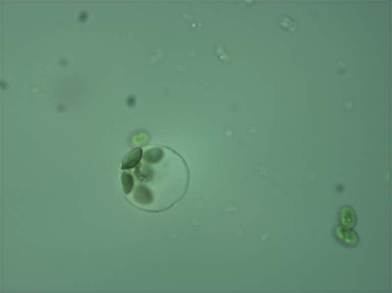 拟南芥保卫细胞原生质体提取中观察到的图片(400倍),请大神帮我看看