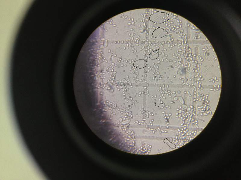 我在做酵母发酵试验,发现不灭菌的培养基会滋生很多细菌,除了灭菌之外