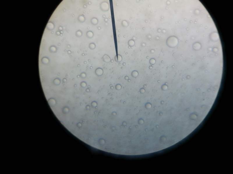 微囊的显微镜下形态图图片