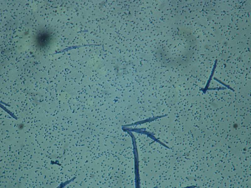 链球菌油镜图片