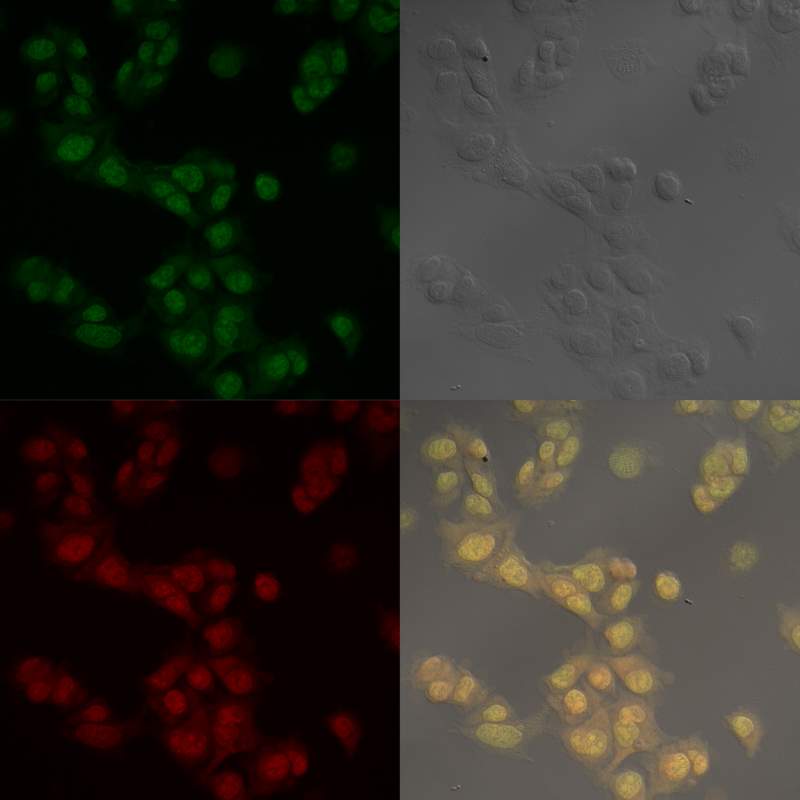 吖啶橙细胞染色