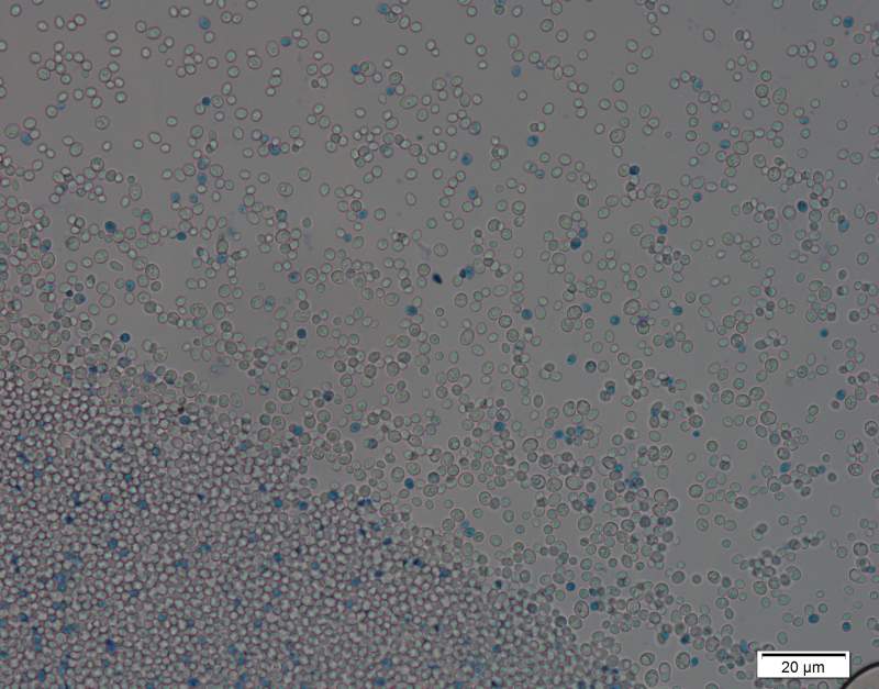 酵母菌的子囊孢子图片