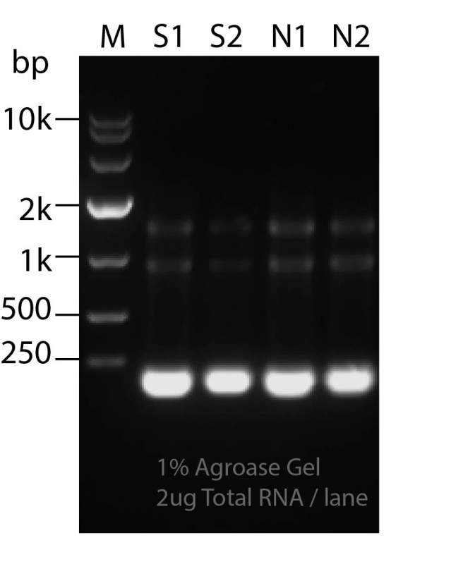 coli total rna 提取,5s 底部条带特别亮,28s和18s较弱,这是什么砸蝌