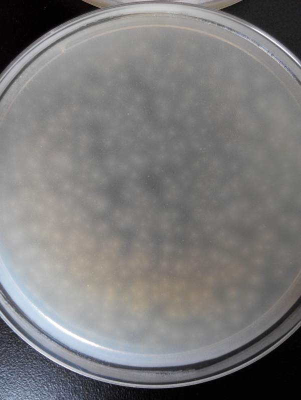 肠球菌菌落图片