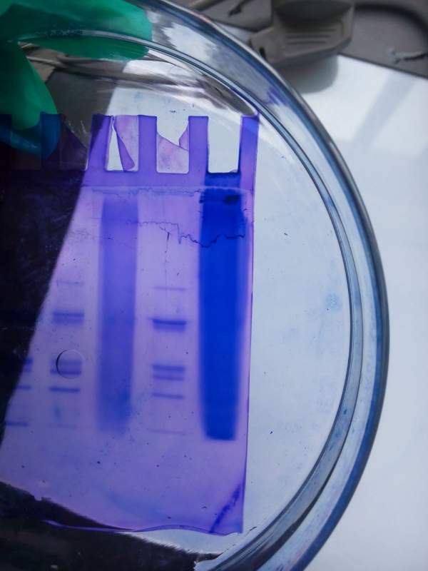 蛋白电泳遇到困难望高人指点