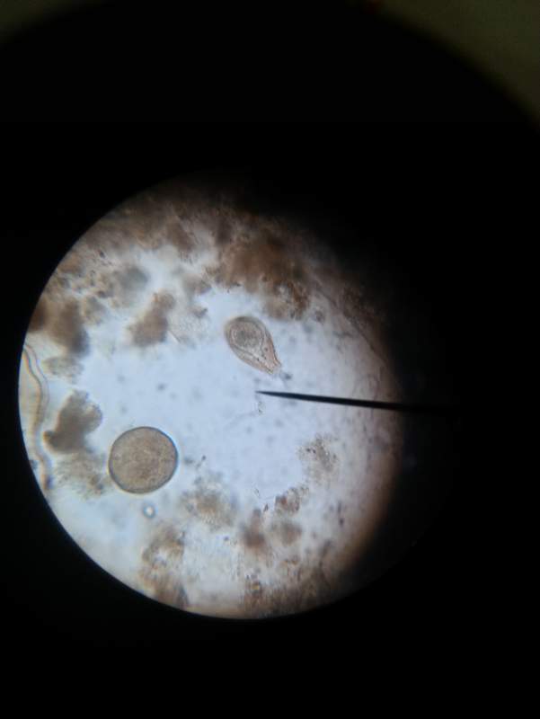 钟虫显微镜图片