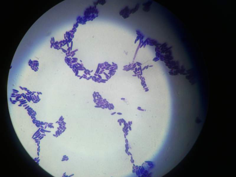 酵母菌显微镜下图片