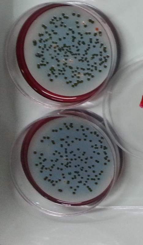 滤膜法测大肠杆菌