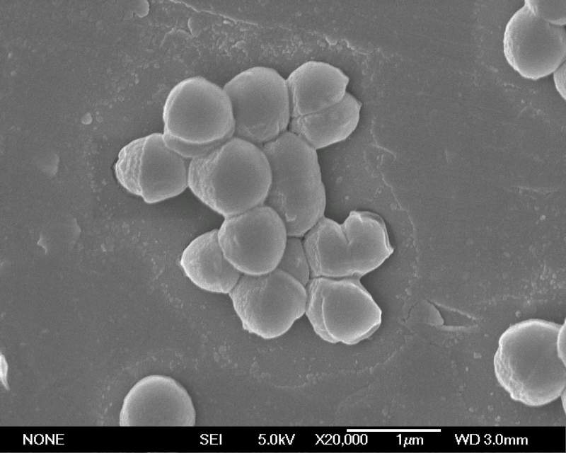 em菌显微镜图片