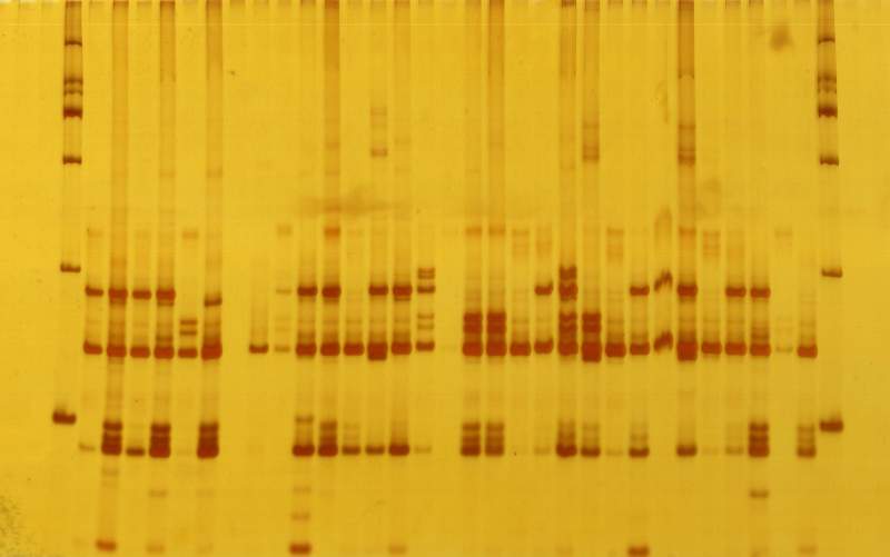 popgen軟件中,ssr標記的聚丙烯電泳條帶怎麼統計 - 分子生物 - pcr