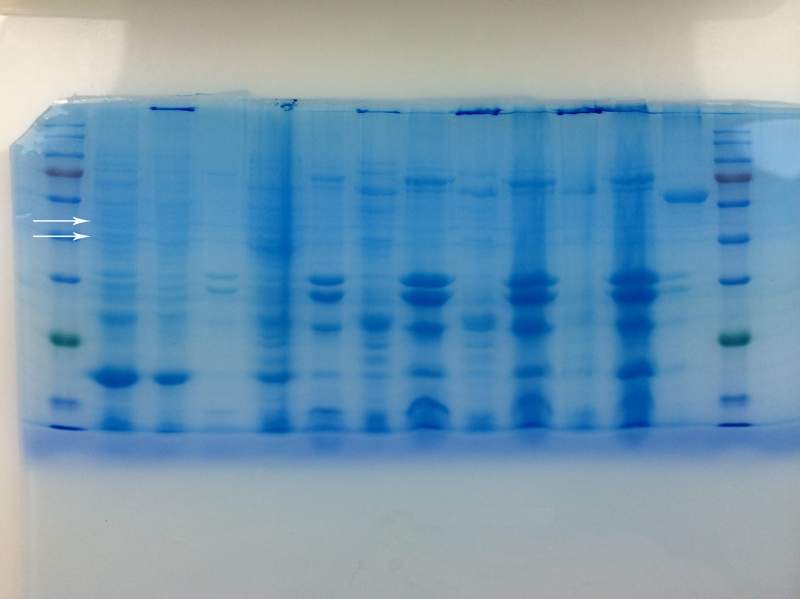 生物科學 蛋白電泳/wb sds-page考馬斯亮藍染色後有莫名其妙的條帶,求