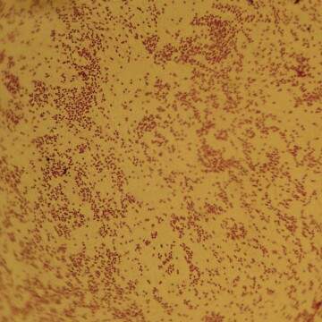 求助一种异养硝化细菌的革兰氏染色图片