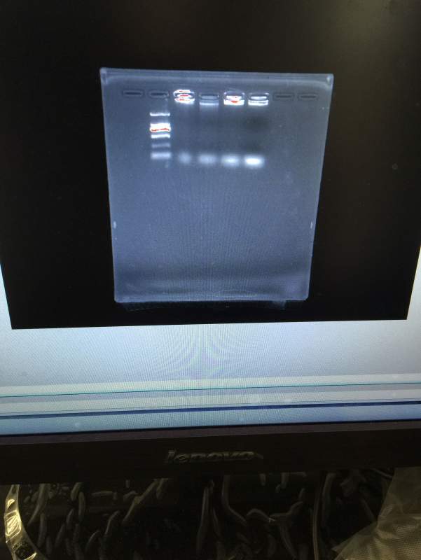 提取的dna跑的琼脂糖检测的这样可以接着往下pcr吗