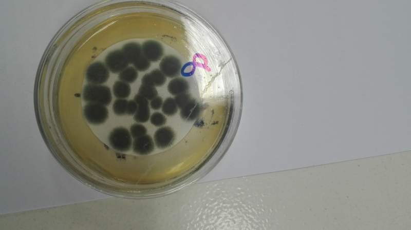 产气荚膜梭菌油镜图片