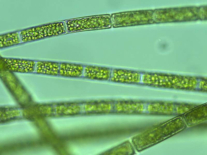 这种淡水藻类是水绵吗?为什么看不到环状的叶绿体?