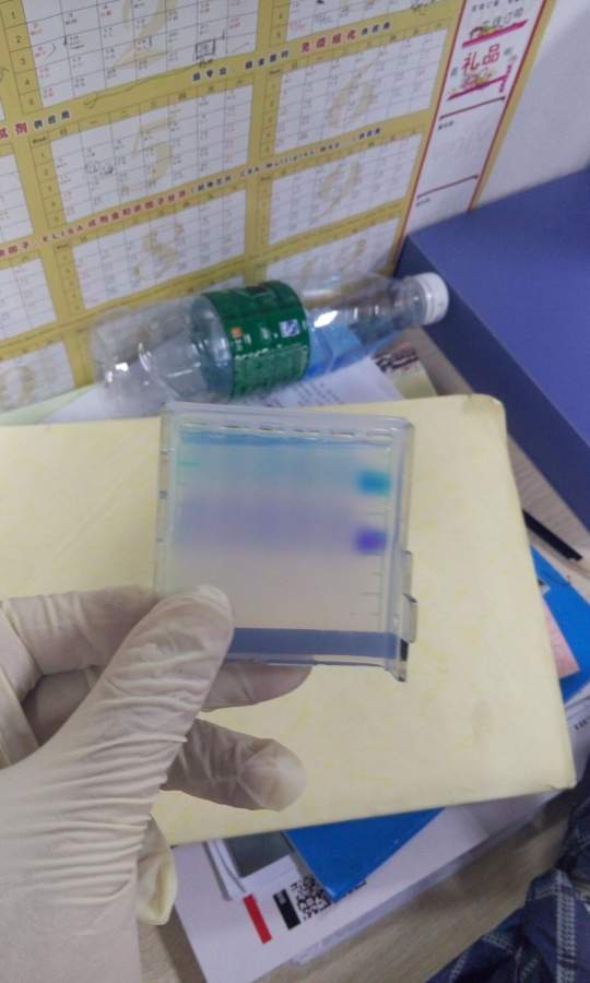 然后回收目网络生活区 有奖问答 实验讨论 pcr产物凝聚电泳后发现样品