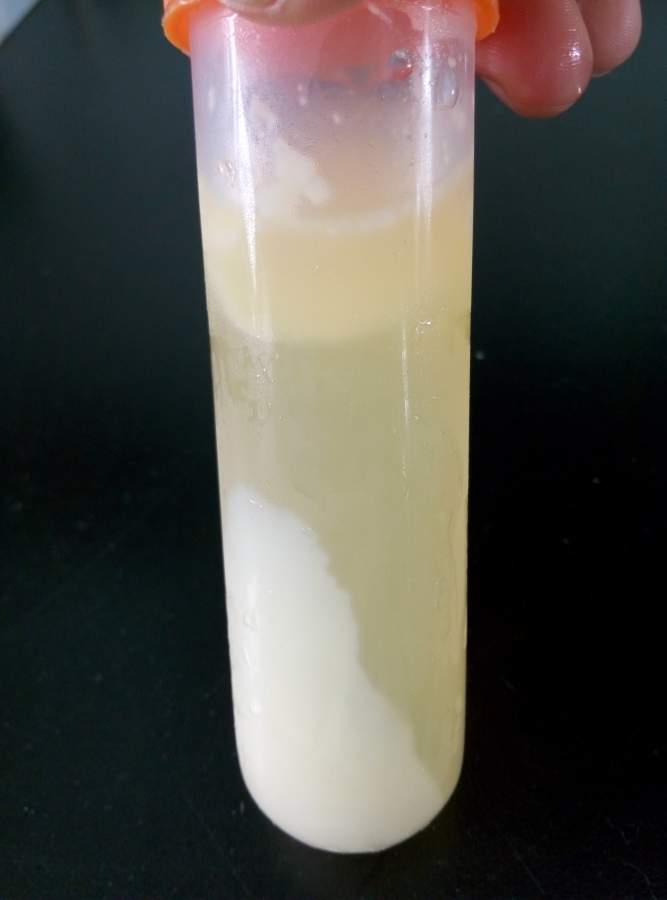 硫酸铵盐析纯化卵黄抗体遇到问题