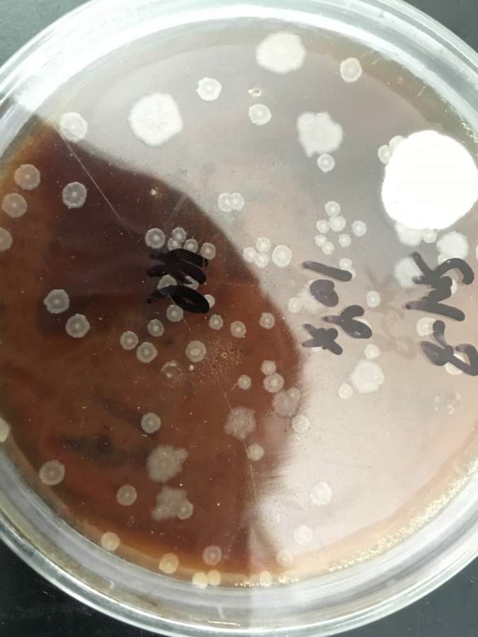 常见细菌菌落图片图片