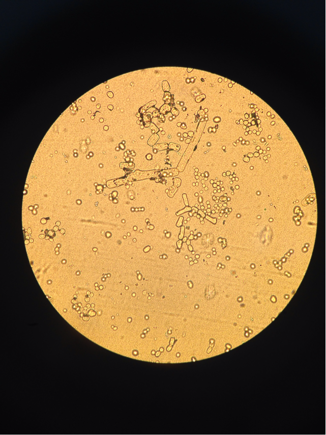 白喉棒状杆菌镜下形态图片