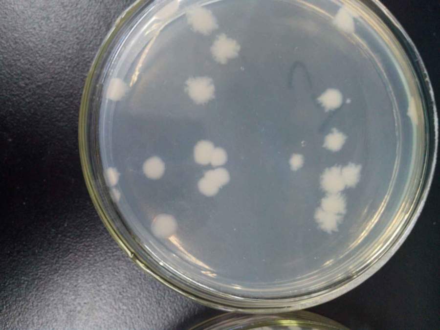 为什么涂布的大肠杆菌有时候会这样就是感觉菌落周围有些物质谢谢