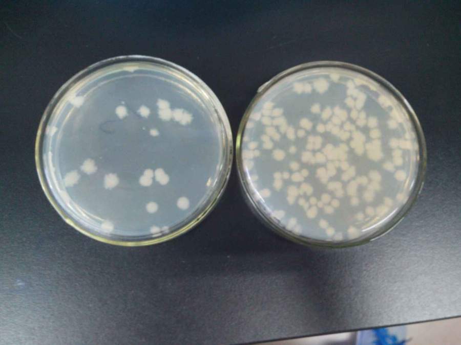 为什么涂布的大肠杆菌有时候会这样就是感觉菌落周围有些物质谢谢