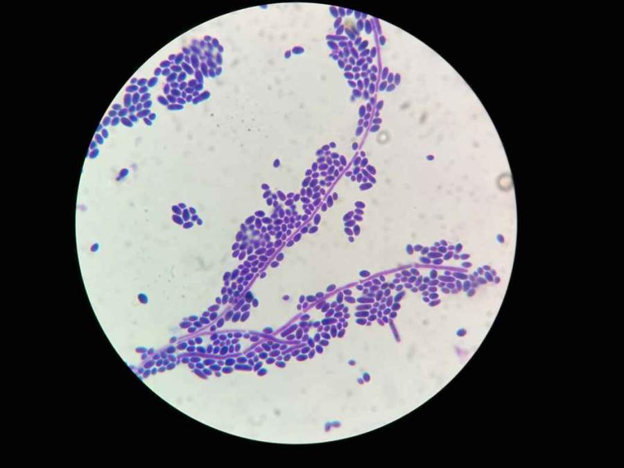 白色念珠菌厚膜孢子图片