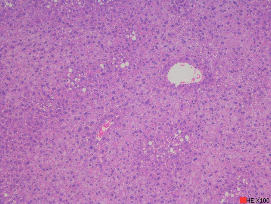 求助讀片小鼠肝臟he切片脂肪變性炎症等10周齡左右