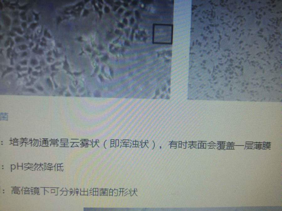 肝星状细胞污染黑胶虫细菌支原体