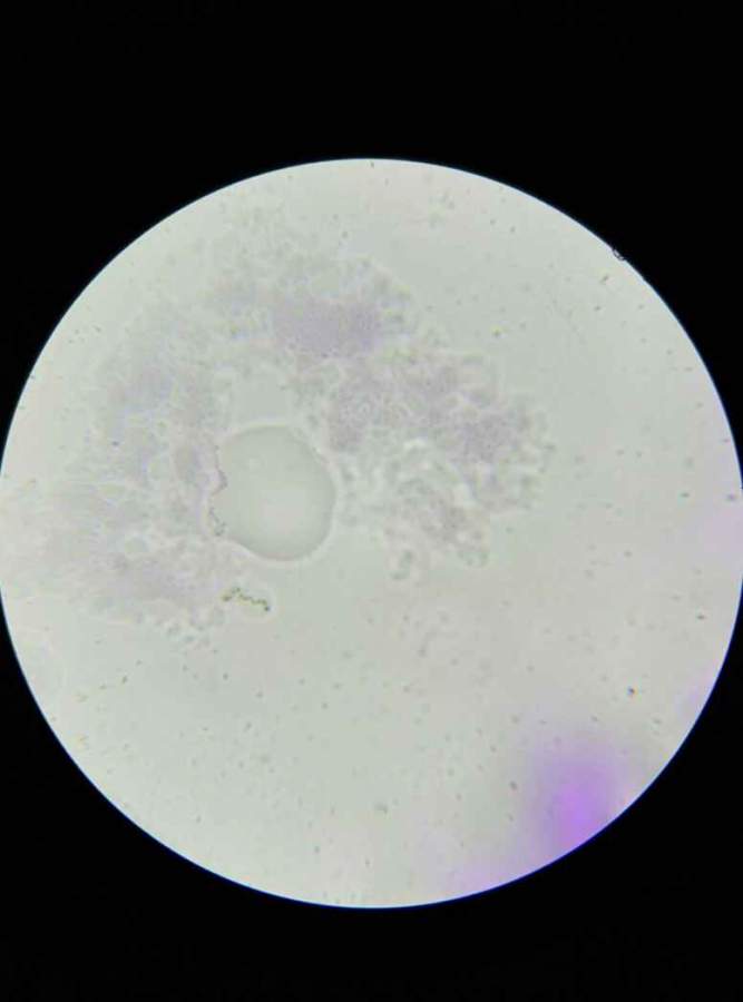 这些小点像不像球菌?油镜看的,没看到杆菌呢?