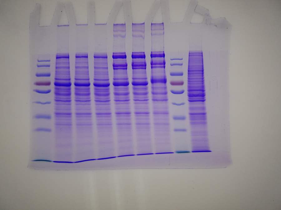sdspage考染后有条带模糊是怎么回事