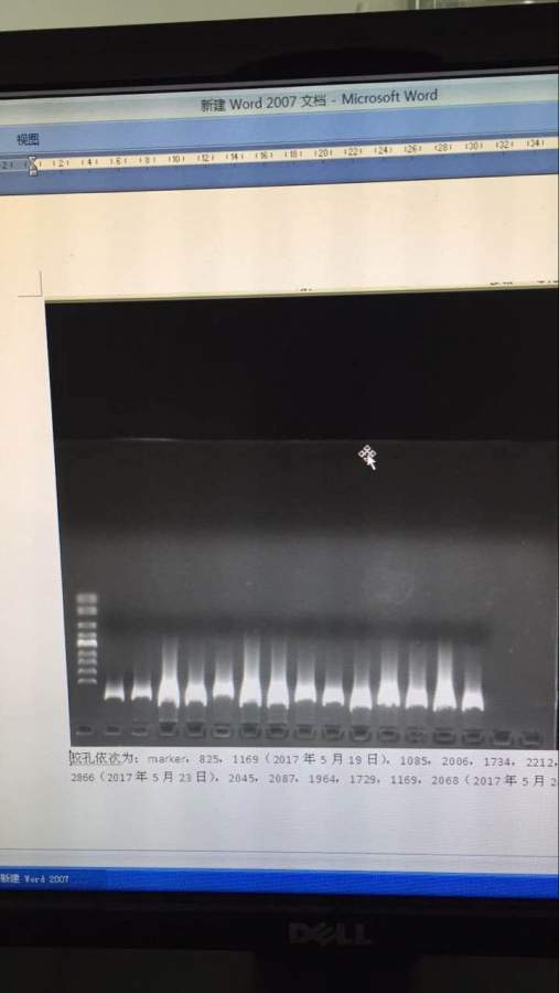 為什麼什麼我用qiagen提取植物dna跑膠總是彌散的