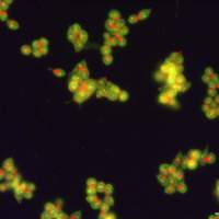 自噬吖啶橙染色