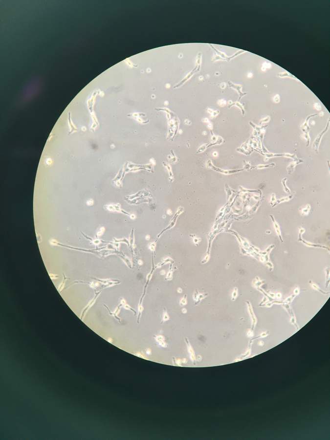 hsct6細胞疑似汙染支原體病毒or其他