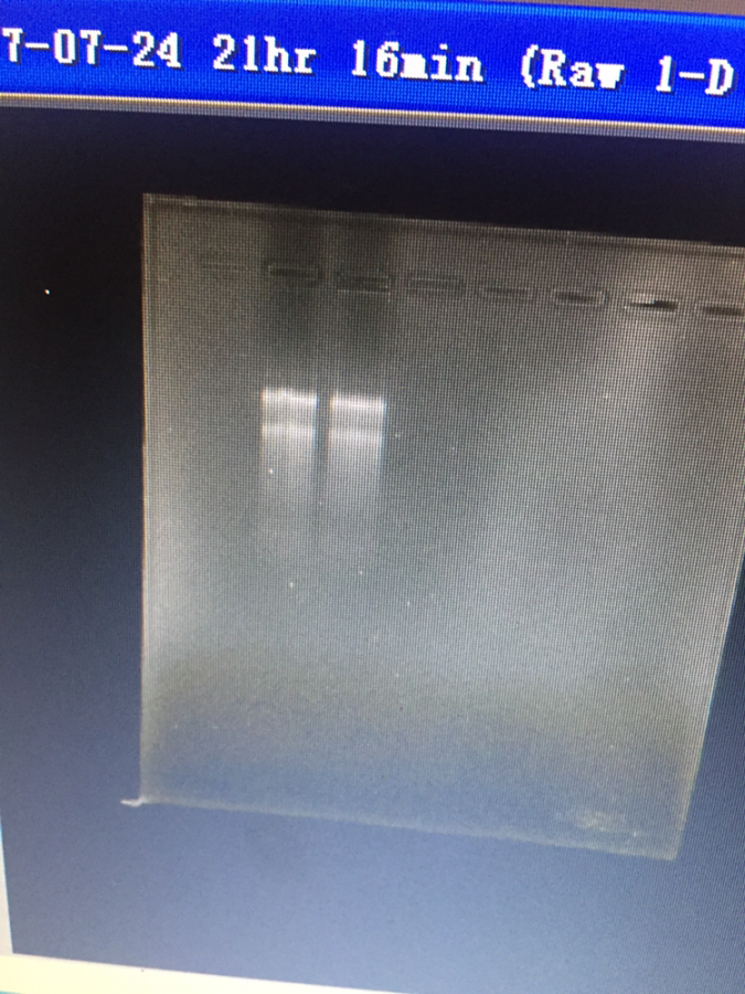 rna非变性电泳跑出来的图,木虫的大神帮我看看这个是不是降解了.