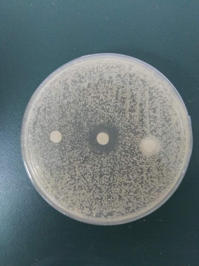 请教微生物抑菌圈的一个问题
