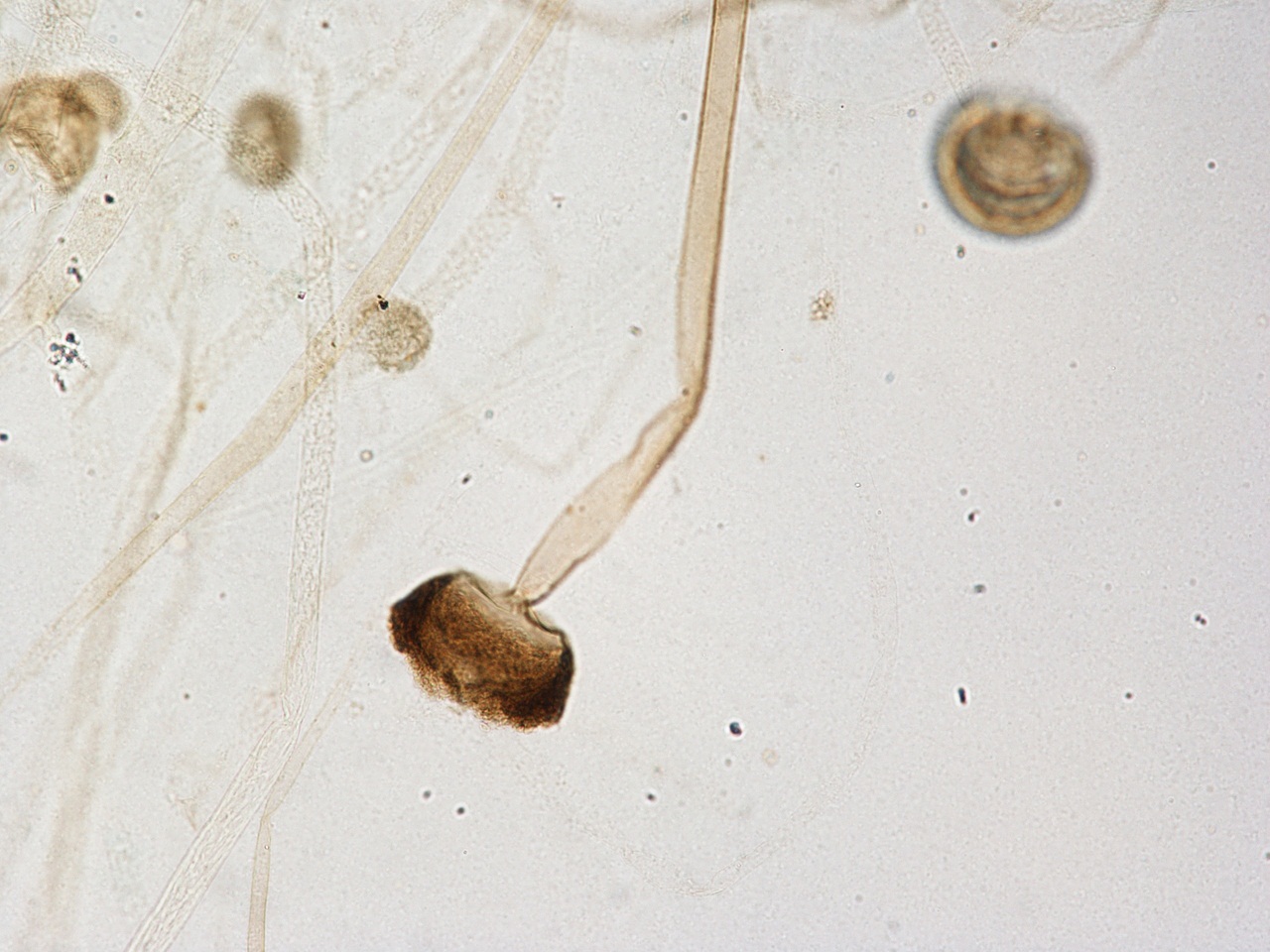 用普通电子显微镜可以看到真菌的子囊及子囊孢子吗菌核是不是可以用