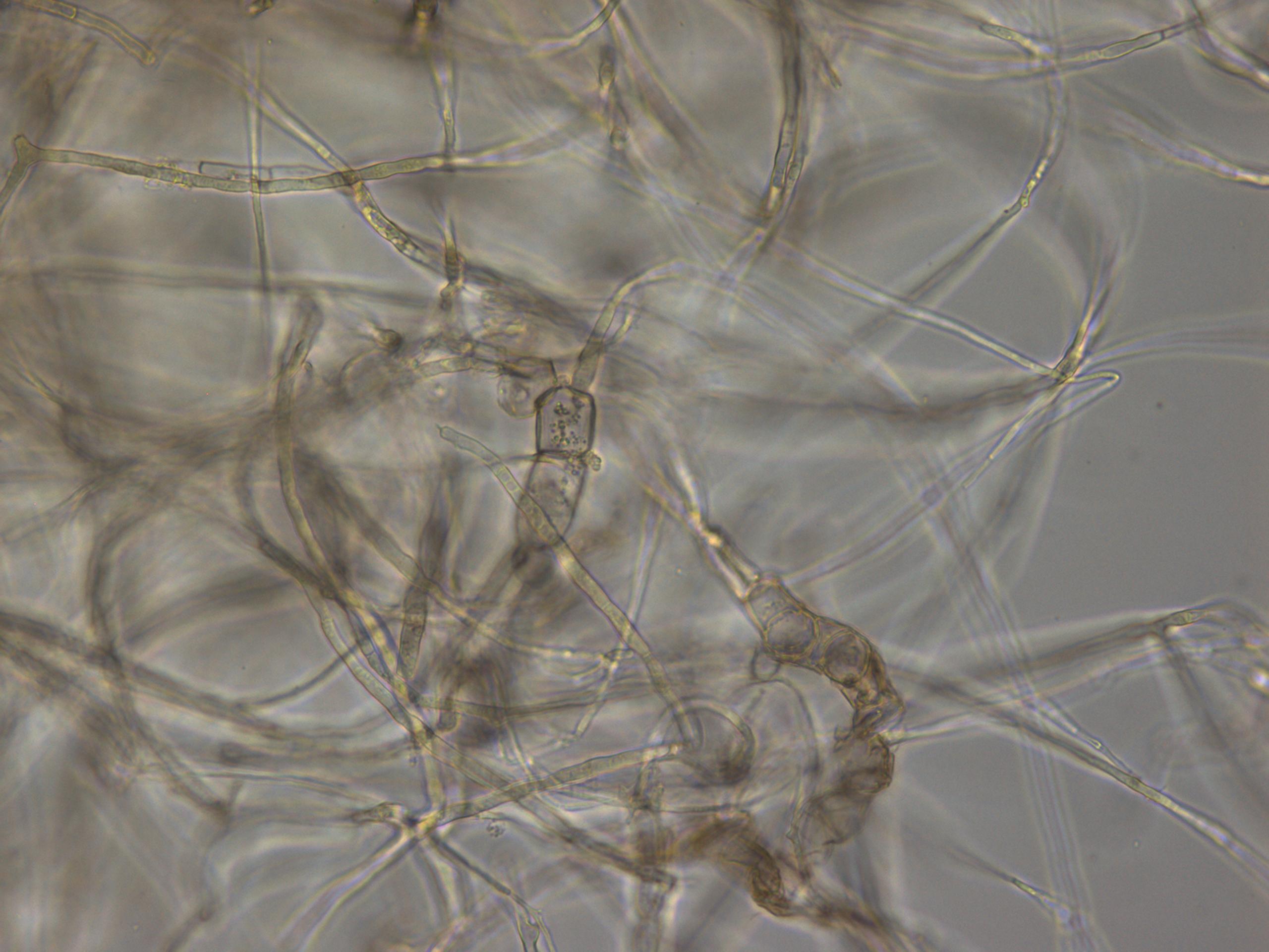 假菌丝和真菌丝图片