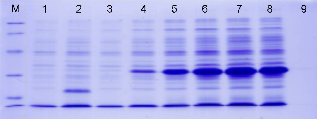 分子生物 查看话题 今天跑的sds-page,mark如图,可是胶里面怎么少了