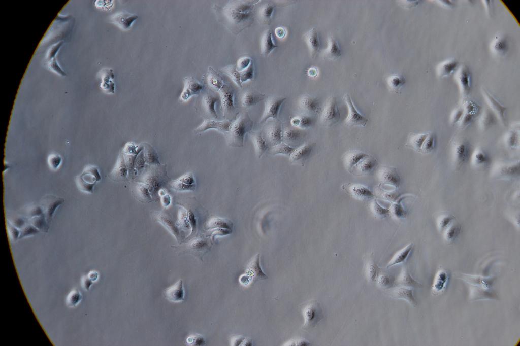 泡沫细胞形态图片