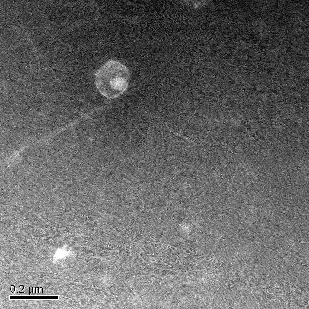噬菌体透射电镜负染照片